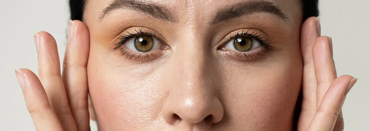 Say Goodbye To Spider Veins With Cutera Excel V+